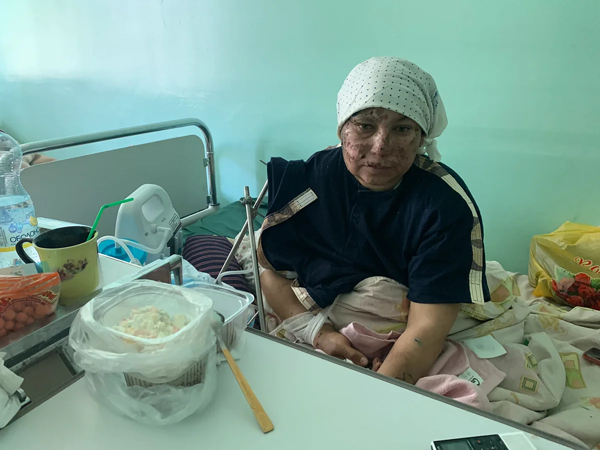 Рита Гусакова выжила после удара российского дрона «Ланцет» в маршрутку. Фото: Ольга Мусафирова