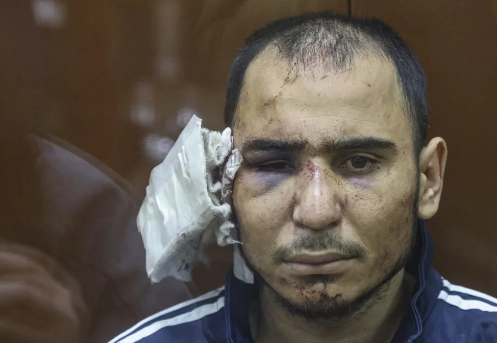 Suspected Crocus City Hall gunman Saidakrami Rachabalizoda seen in court with his ear bandaged. Photo: EPA-EFE/SERGEI ILNITSKY