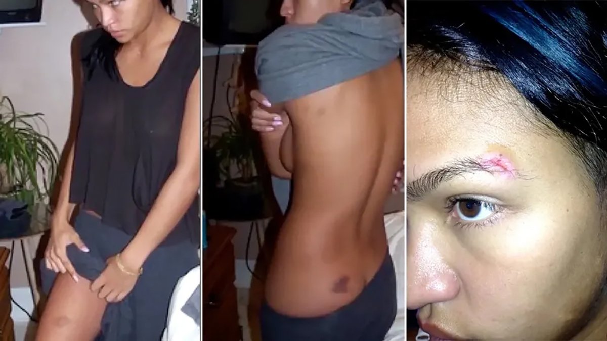 Фотодоказательства, предположительно свидетельствующие о жестоком обращении Шона Комбса с Кэсси Вентурой. Фото:  fox5ny.com